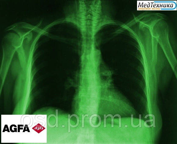 Рентгеновская пленка AGFA  Curix Ortho HT-G  Зеленочувствительная пленка
