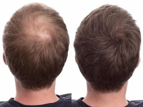 Загуститель для волос Toppik Hair Building Fibers Light brown Загуститель для волос caboki
Загуститель для волос Toppik Hair Building Fibers Light brown Загуститель для волос caboki
