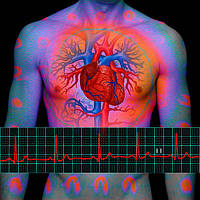 Инфаркт миокарда, реабилитация, атеросклероз, холестерин, для сердца, сосудов Коллоидные фитофорулы Арго 