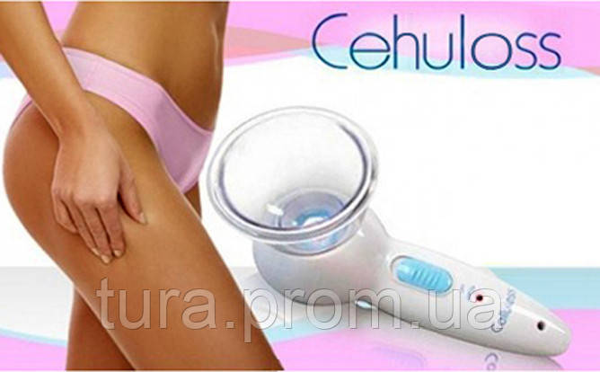 

Вакуумный Антицеллюлитный Массажер Cehuloss