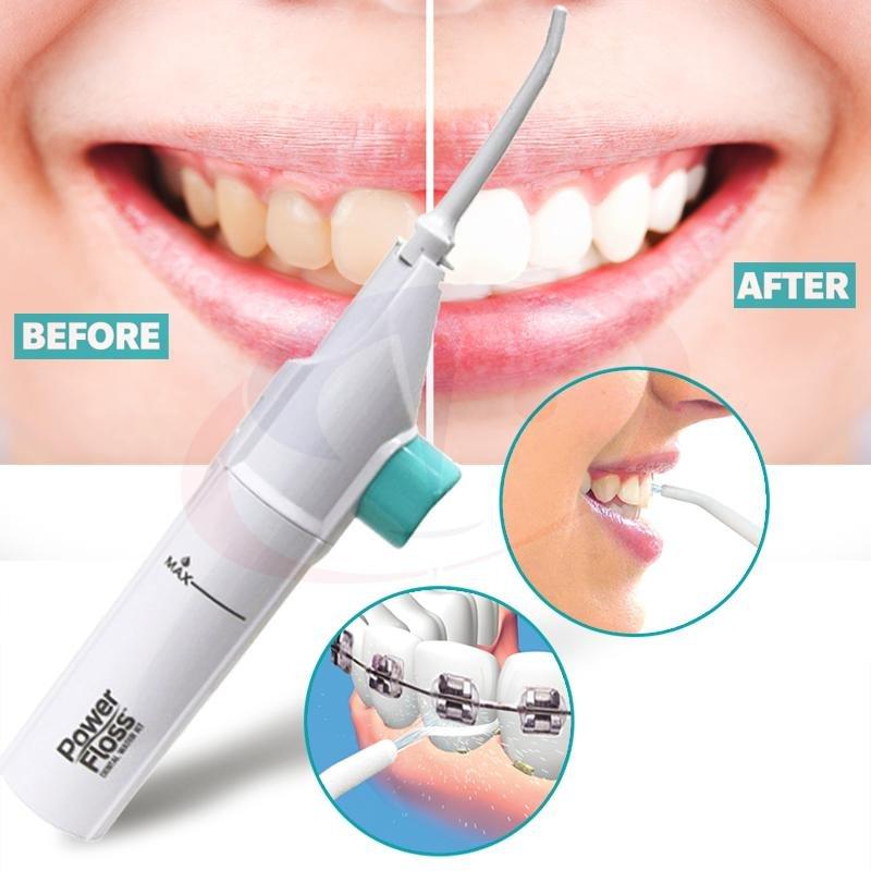 чистка зубов аппаратом ирригатором