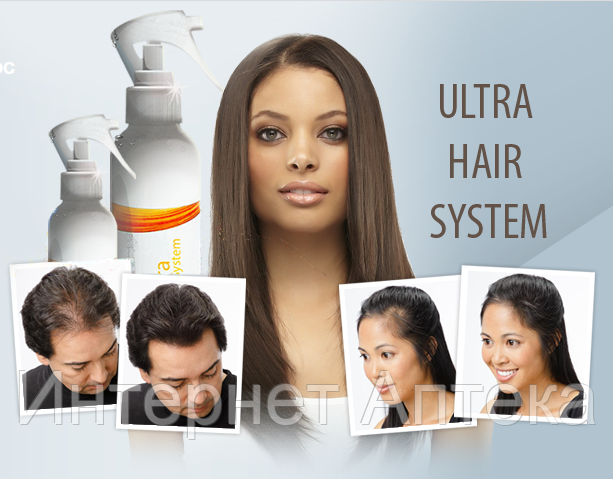 ultra hair system