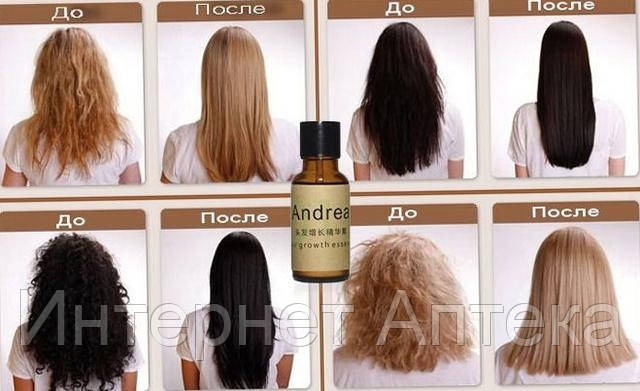 Средство для роста волос Andrea
