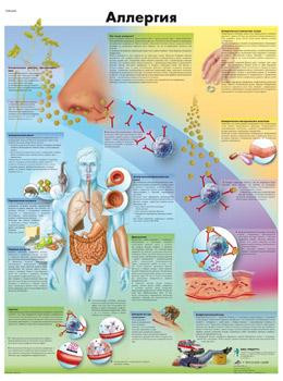 

Анатомический плакат 67х50см. (аллергия)