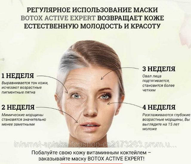 Botox Active Expert