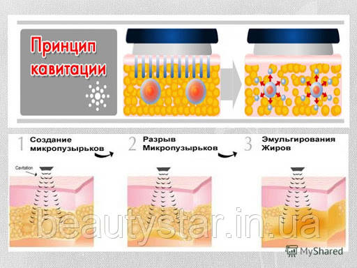 Апарат для уз кавітації