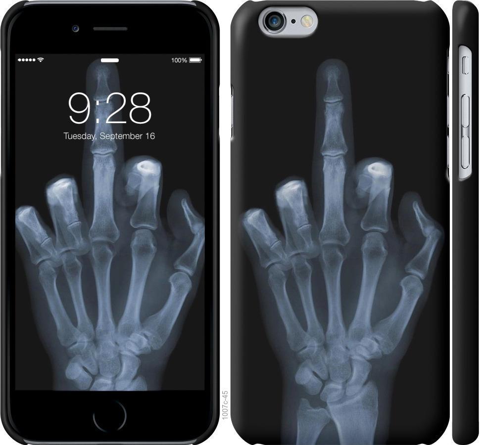 Чехол на iPhone 6s Рука через рентген