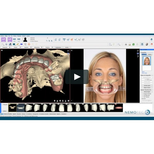 

NemoSmile Design 3D