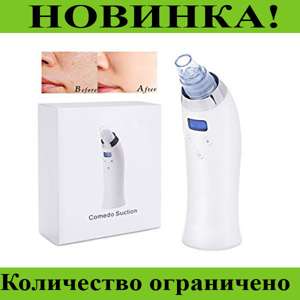 

Вакуумный очиститель лица Comedo Suction! Распродажа