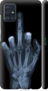 Чехол на Samsung Galaxy A51 2020 A515F Рука через рентген "1007c-1827-44084, Черный