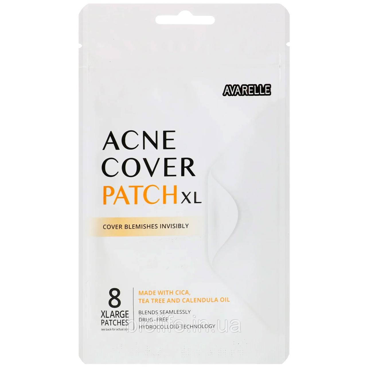 

Avarelle, Acne Cover Patch XL, 8 XLarge Patches