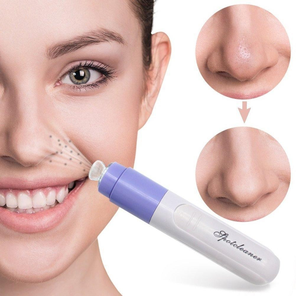 

Очиститель пор для лица Face Spot Cleaner, Face Pore Cleaner