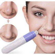 Вакуумный очиститель пор для лица Pore Cleanser Skin Cleaner, Аппарат косметологический и дерматологический, фото 2
