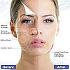 Портативний ультразвуковий Скрабер для шкіри обличчя зігріваючий Heating Skin Scrubbe, фото 8