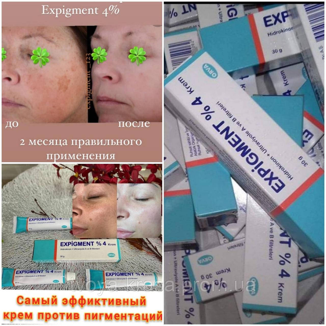 Expigment Крем Купить В Москве