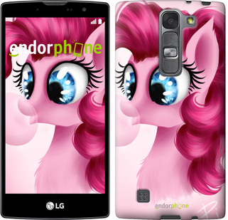 

Чехол на LG G4s H734 Pinkie Pie v3 "3549c-389", Розовый